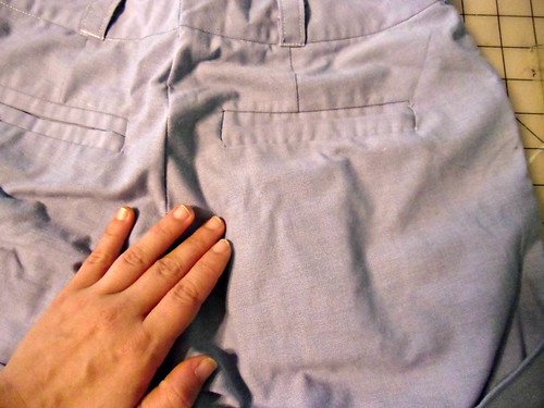 Modified Thurlow pocket